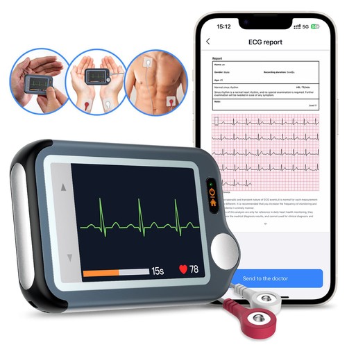 Checkme monitor ecg - checkme, portatile